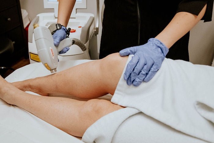 IQ Laser Hair Removal for Caucasian & Ethnic Skin - Espace Skins Montreal